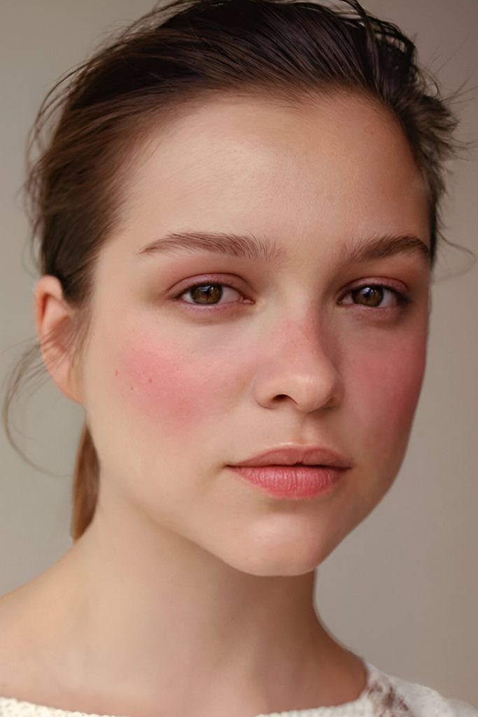 Get That 'Just Took a Walk in the Cold' Rosy Flush